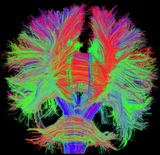 Colorful brain scan using tractography 3D modeling technique with diffusion MRI