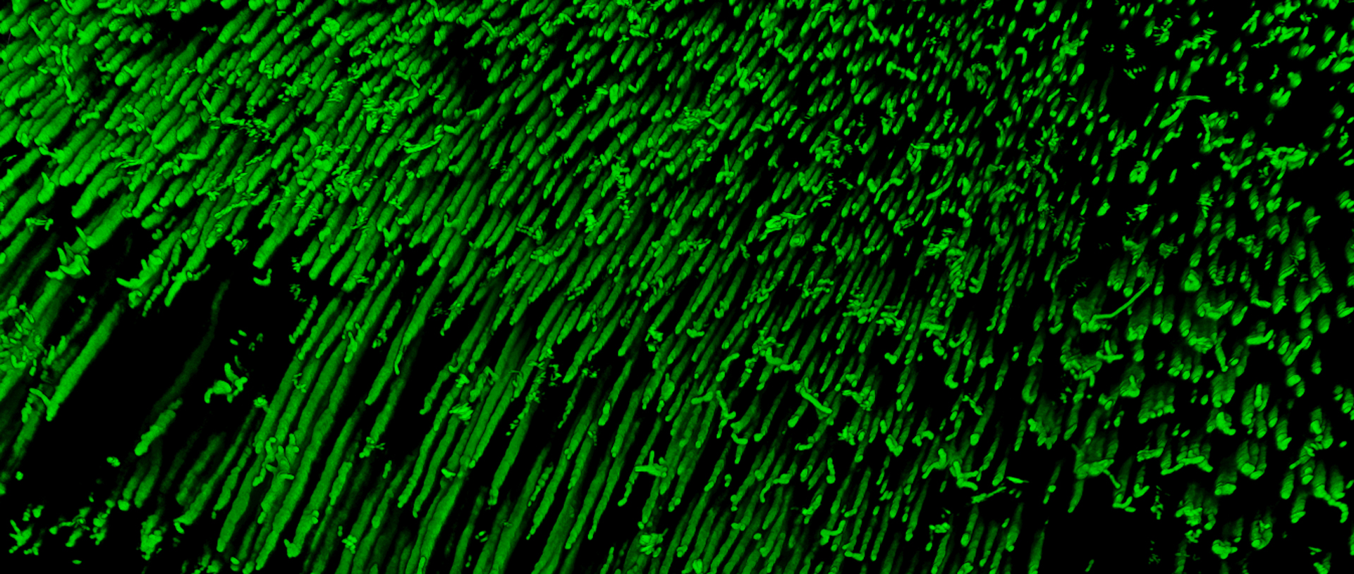 imaging of dentin slices shows many small repeating green strands