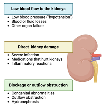 Diagram showing the risk factors of AKI: blood flow, kidney damage, and blockage/outflow obstruction.