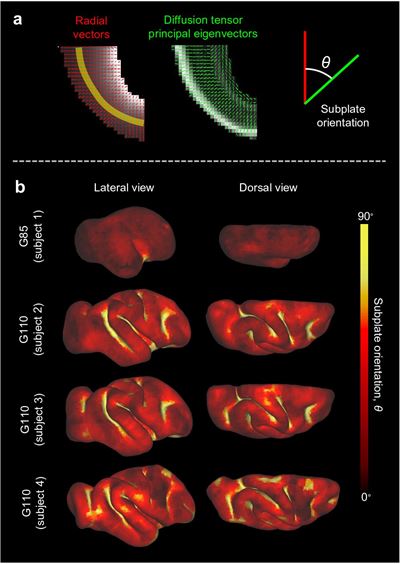 brain folding imaging data in a graphic from publication